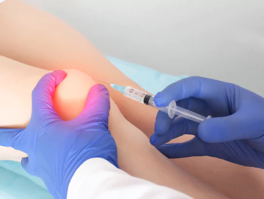 Intraarticular (Joint) Injections